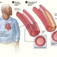 p-18292-heart-featured image