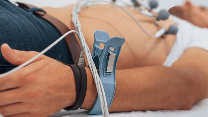 p-97674-ecg
